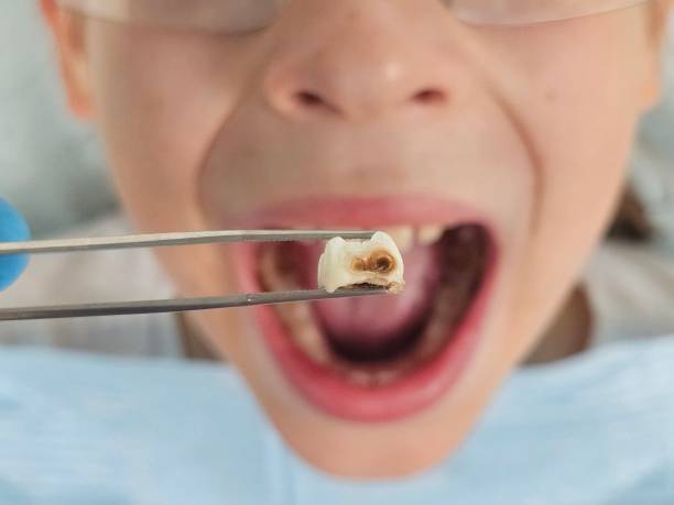 Best Emergency Orthodontic Repairs in New Fairview, TX
